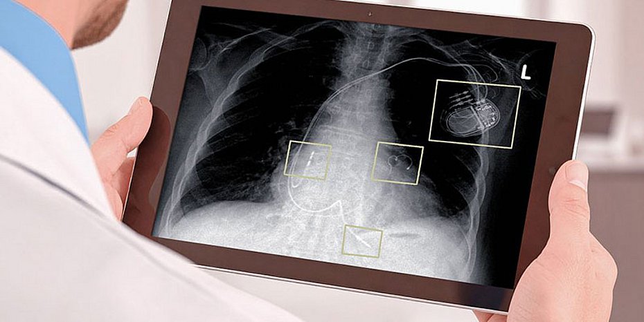 Platinbeschichtung Medizintechnik Platin-Elektrolyt